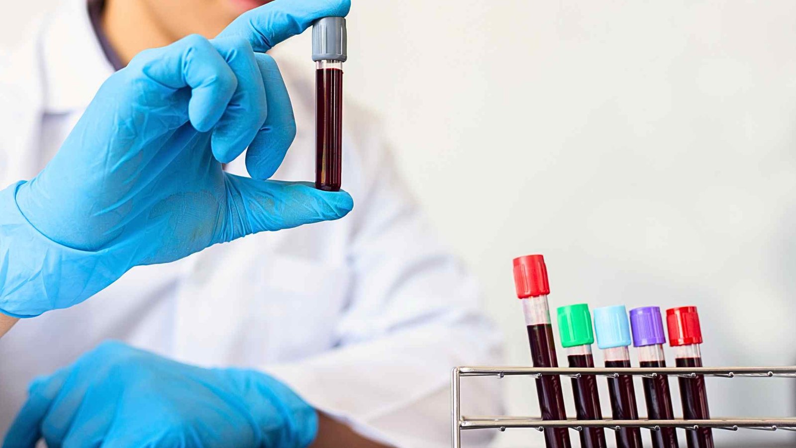 Simples exame de sangue revela ‘quanto tempo de vida’ você pode ter